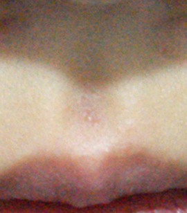 After